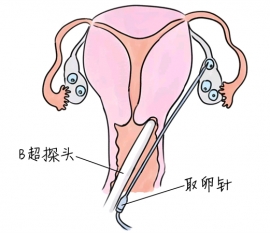 幼儿学画画，南昌捐卵宝宝学画画，学画画的好处，如何学画画