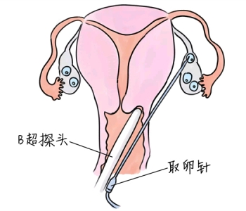 幼儿学画画，南昌捐卵宝宝学画画，学画画的好处，如何学画画